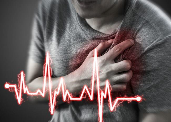 heart attack heart attack